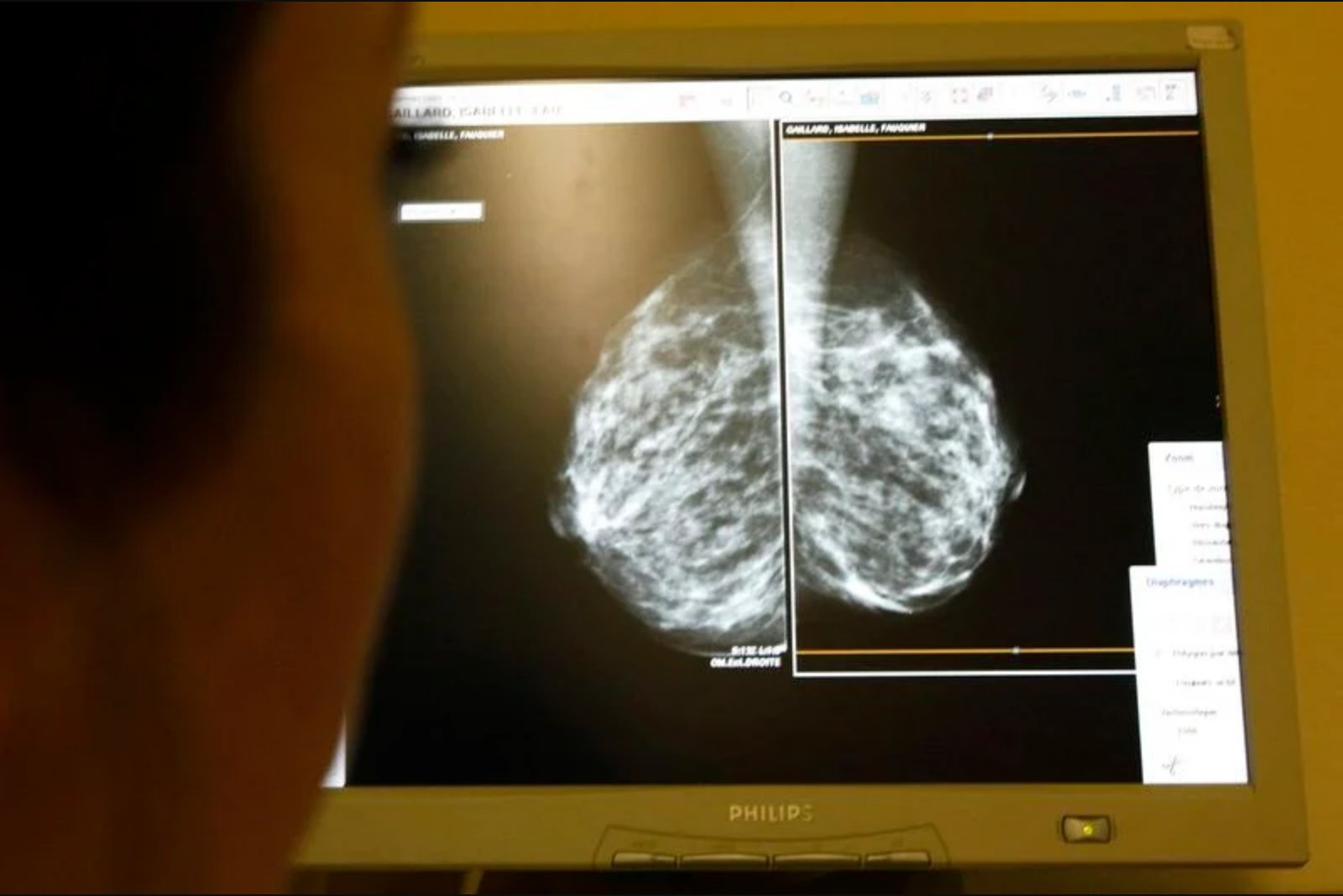 Celcuity Shares Slip After FDA Approval as Commercial Launch Is Postponed