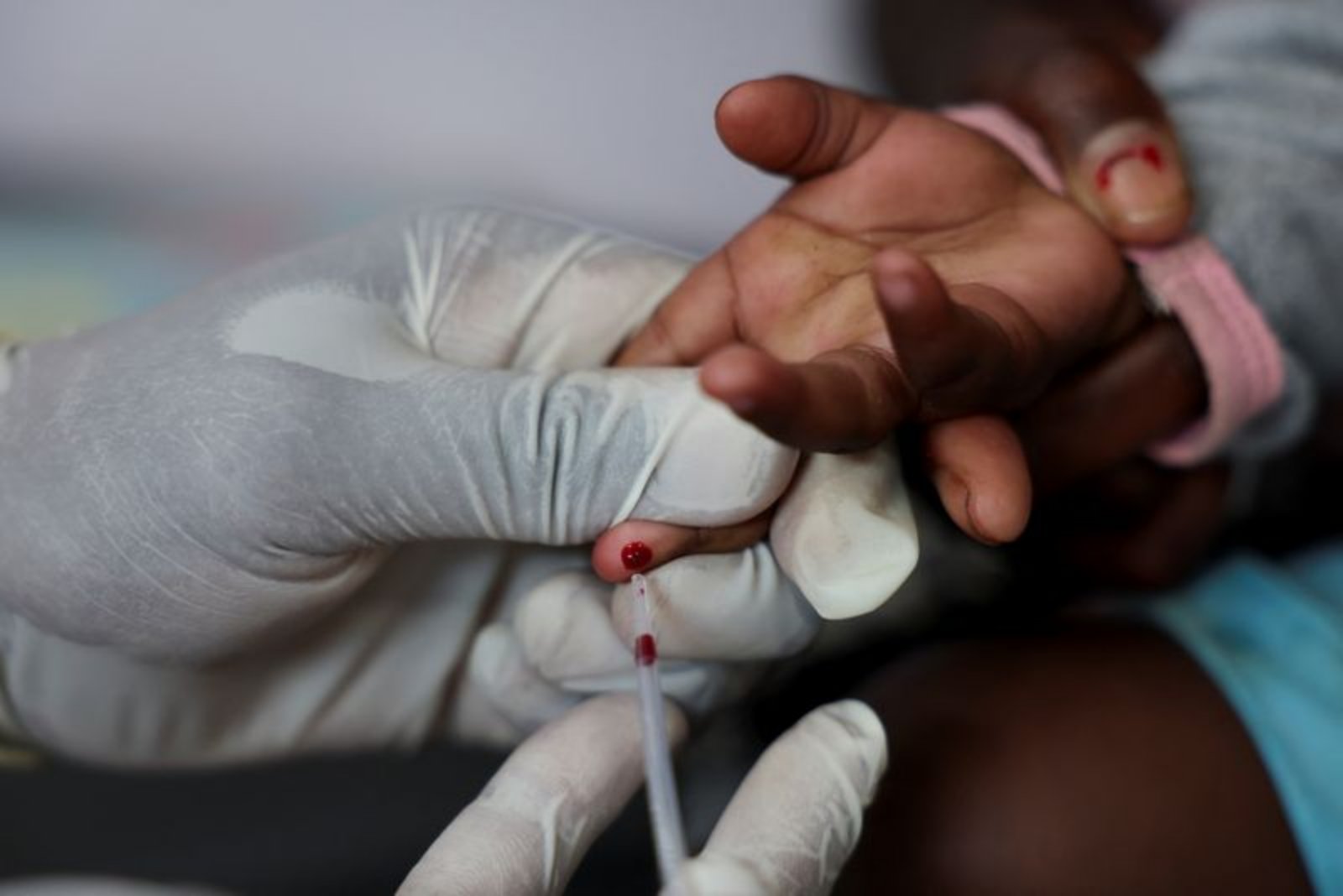 U.S. Aid Reductions Disrupt HIV Prevention Efforts as New Injectable Drug Arrives in South Africa